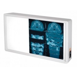 NEGATOSCOPE 2 PLAGES